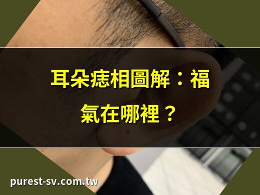 耳朵上長痣